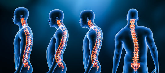 HOW POOR POSTURE AFFECTS MORE THAN WE THINK!